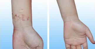 昆明最適合割雙眼皮的醫(yī)院是哪家？重點推薦的幾家醫(yī)院有哪些？