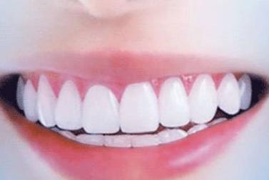 武漢伊萊美美容整形醫(yī)院資質(zhì)如何？口碑怎么樣？有哪些擅長的項目推薦呢？為你揭秘！伊萊美醫(yī)院值得信賴嗎？