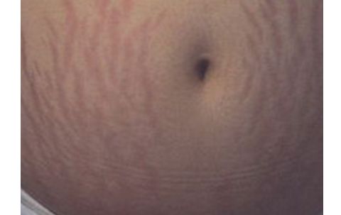 南昌佳美整形醫(yī)院：醫(yī)生團隊強大，雙眼皮案例獨具匠心