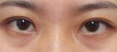 上海悅?cè)R醫(yī)療美容門診部真的有醫(yī)生特長介紹和價格表參考嗎？可以期待嗎？