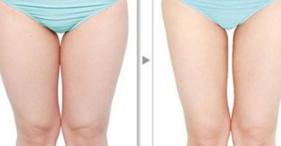 成都吳江山隆胸專(zhuān)家分享醫(yī)生實(shí)力和患者經(jīng)歷