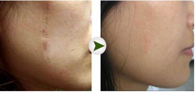 2023昆明地區(qū)頂級鼻部整形醫(yī)院排行榜揭曉！悉數(shù)解析各院隆鼻技術(shù)獨到之處