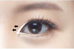 禪城區(qū)中心醫(yī)院整形科成功改變徐威強(qiáng)下頜角，告別「方姐」稱號(hào)！