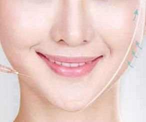 大坪醫(yī)院金絲骨針術(shù)醫(yī)師值得推薦，服務(wù)價(jià)格一覽無余！