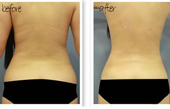 北京哪位醫(yī)生在八大處進行隆胸手術較為專業(yè)？