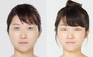 廣州哪家醫(yī)院能夠有效除皺？詳細(xì)介紹醫(yī)院基本情況分享