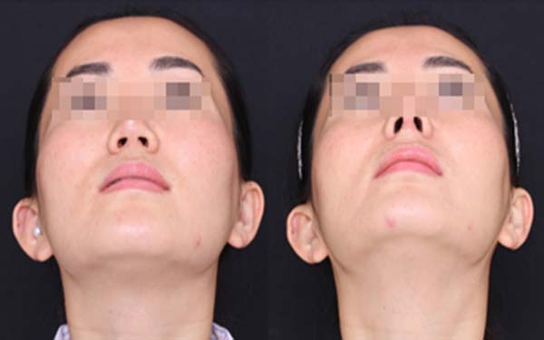 淄博麗人醫(yī)院整形美容科靠譜嗎？有口碑醫(yī)生推薦嗎？
