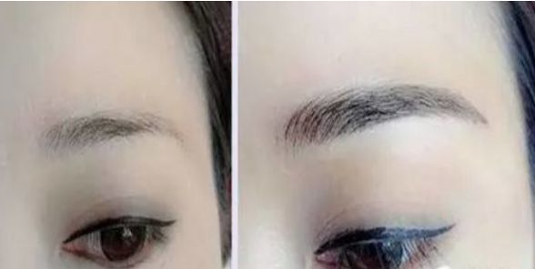 上海最受醫(yī)生推薦的醫(yī)美中心，瑞金整形項(xiàng)目?jī)r(jià)格公開！