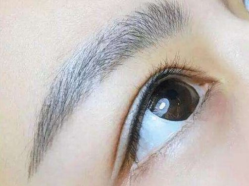 醫(yī)生技術(shù)驚艷！重醫(yī)賀光照眼部整形迎來新突破