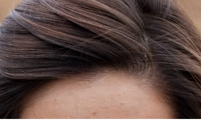 陽(yáng)泉煤業(yè)集團(tuán)總醫(yī)院整形美容科2023價(jià)格表：優(yōu)惠價(jià)格真實(shí)可信嗎？醫(yī)師團(tuán)隊(duì)經(jīng)驗(yàn)豐富？