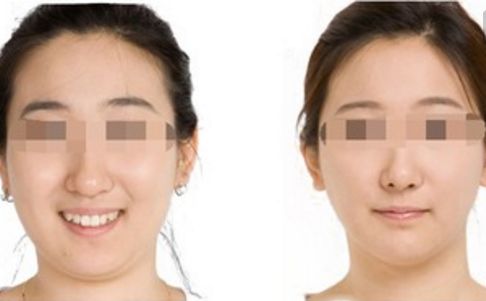 鄭州哪位醫(yī)生在鼻整形領域赫赫有名？口碑出類拔萃的五位專家揭曉！