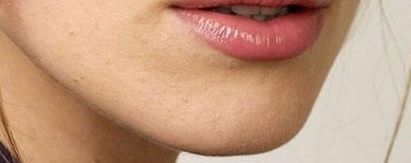 2023年北京大腿脂肪醫(yī)院排名對比，醫(yī)療技術強勁競爭