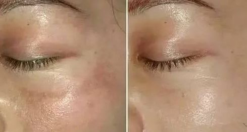 常州市第一人民醫(yī)院整形燒傷科：找對醫(yī)生，就對了！