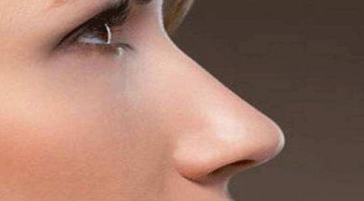 雙眼皮修復(fù)失敗后的最佳時機是什么時候？