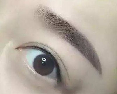 廈門哪家整形醫(yī)院口碑好？專家推薦薇格、中山前三！