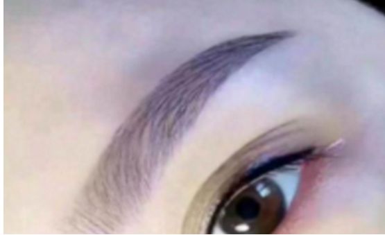 上海求美醫(yī)院最權威的拉皮整形專家名單及案例分享，查看收費明細表