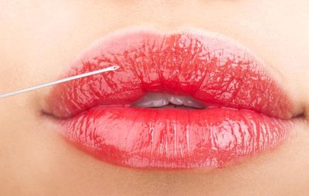 徐斌醫(yī)生手術果效如何？金華芘麗芙整形醫(yī)院聲譽如何？