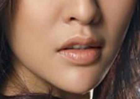 滄州中心醫(yī)院整形科馬超雙眼皮修復(fù)有哪些效果？是否可持久保持雙眼皮效果？