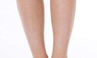 北京聯(lián)合麗格王巖醫(yī)生雙眼皮療效大揭秘，令人驚艷的成功案例浮出水面