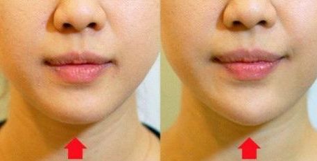 安徽乳房修復(fù)整形醫(yī)院哪家靠譜？公立三甲推薦！專家團(tuán)隊(duì)值得信賴