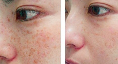 贛州亞韓醫(yī)療美容門診部整形手術(shù)適合嗎？吳禮誠醫(yī)生技術(shù)評(píng)價(jià)如何