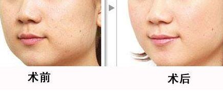 北京清華長庚醫(yī)院為何不列入三甲？整形技術(shù)如何？名醫(yī)推薦給你