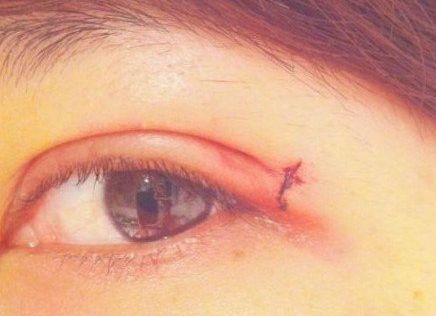 南寧受追捧的整形醫(yī)院，魅力明星推薦，獨特亮點閃耀