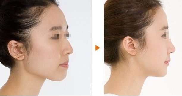 上海九院隆鼻手術(shù)熱門醫(yī)護(hù)人員揭曉！備受追捧的醫(yī)療達(dá)人！