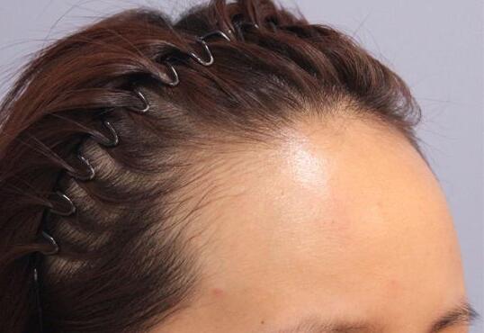 哈爾濱羽禪醫(yī)美，哪些熱門項目受歡迎？