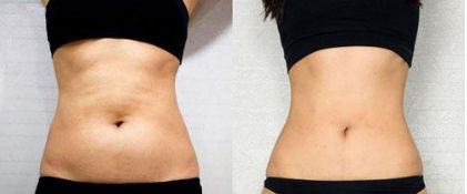 北京下頜角顴骨矯正，這幾家醫(yī)院排名前五不可信！