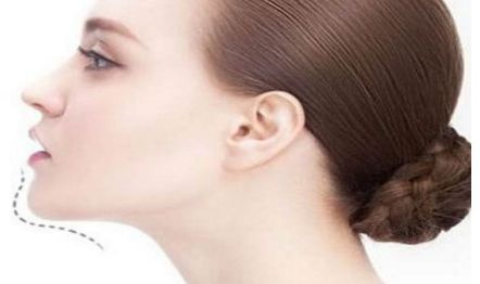 江門植發(fā)醫(yī)院專業(yè)推薦！華美植發(fā)、瑪恩植發(fā)被廣大客戶一致好評！