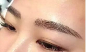 北京五家太陽穴整形醫(yī)院，排名榜揭曉！手術前必知攻略，高能提醒！