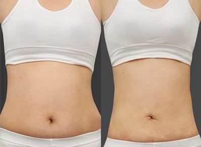 智慧選擇，打造肌膚零瑕疵！廣東祛斑醫(yī)院大比拼，真實實力PK！