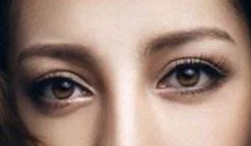 濟南省立醫(yī)院面部吸脂真的靠譜嗎？2023手術恢復過程有親身經(jīng)歷的人嗎？