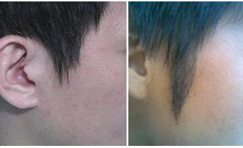 西安著名拉皮手術(shù)醫(yī)生推薦！專家團(tuán)隊(duì)不俗技藝，魯禮新、楊萬(wàn)忠亮相