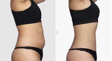 沈陽(yáng)國(guó)防醫(yī)院簡(jiǎn)介：為什么選擇沈陽(yáng)國(guó)防醫(yī)院進(jìn)行醫(yī)美整形？