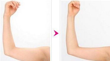 揭曉廣州五大翹楚!不容錯(cuò)過(guò)的豐胸醫(yī)院大盤點(diǎn)