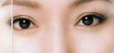 哪個整形科醫(yī)生在北京協(xié)和醫(yī)院備受推崇？醫(yī)術精湛、豐富經驗是參考。