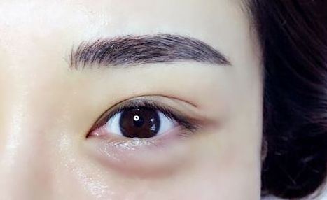 重慶杰出眼科專家范文亮醫(yī)生：醫(yī)術(shù)高超，多個成功案例揭秘