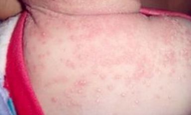 蘇州維多利亞美容醫(yī)院：醫(yī)生團(tuán)隊實(shí)力如何？案例果效反饋醫(yī)生信息匯總