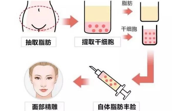 從醫(yī)生個人資料到豐胸案例圖對比，揭秘王沛森的豐胸效果！