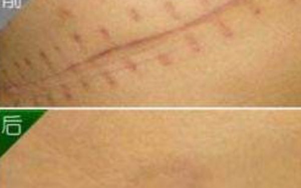 北京非常受歡迎的鼻部整形醫(yī)生，排名一覽！