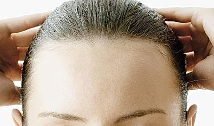 郭建玲雙眼皮修復(fù)費(fèi)用揭秘！看真實(shí)案例圖分享，了解其技術(shù)效果！