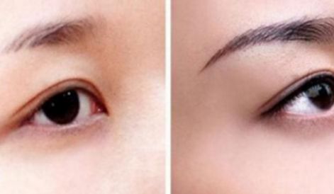 新一期海南隆鼻醫(yī)院名單來(lái)啦！維多利亞實(shí)力引領(lǐng)口碑榜！