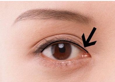 南京胸部整形醫(yī)生吳國(guó)平的最新成功案例！