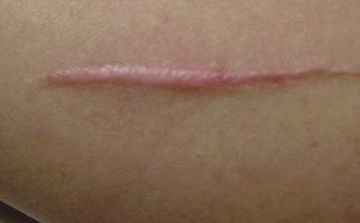 成都比較受推薦的磨骨醫(yī)生排行榜：前十強名單公布！