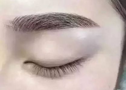 寧波美容整形醫(yī)院有哪些值得關(guān)注？這幾家醫(yī)院的口碑如何？