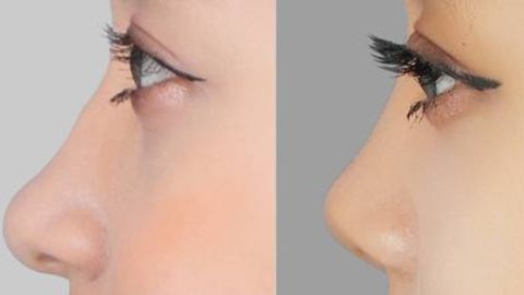 瀘州市更受歡迎的整形醫(yī)院匯總！留言好評口碑實(shí)力大揭秘！當(dāng)?shù)蒯t(yī)美熱門推薦！