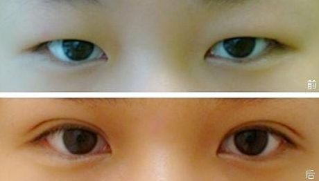 塑造完美鼻型，一觸即達(dá)！隆鼻醫(yī)生品牌推薦，成功案例揭秘，費(fèi)用一覽表震撼來襲