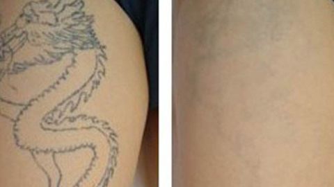 2023年鄭州整形醫(yī)院最新推薦！天后、華領(lǐng)、美萊等全面介紹！